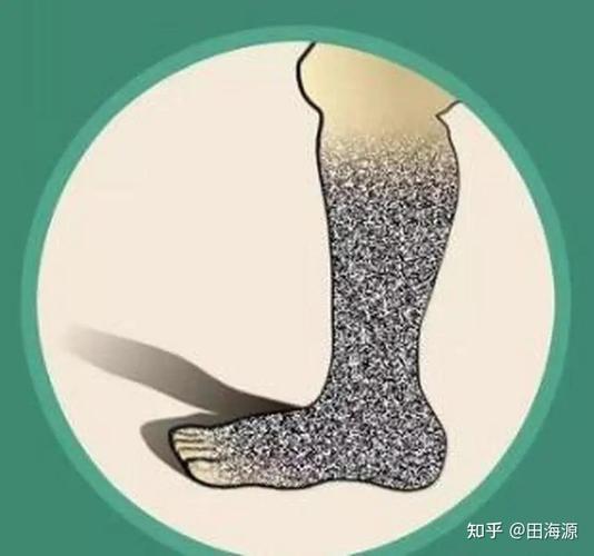 把腿抬高放墙上腿很麻怎么回事